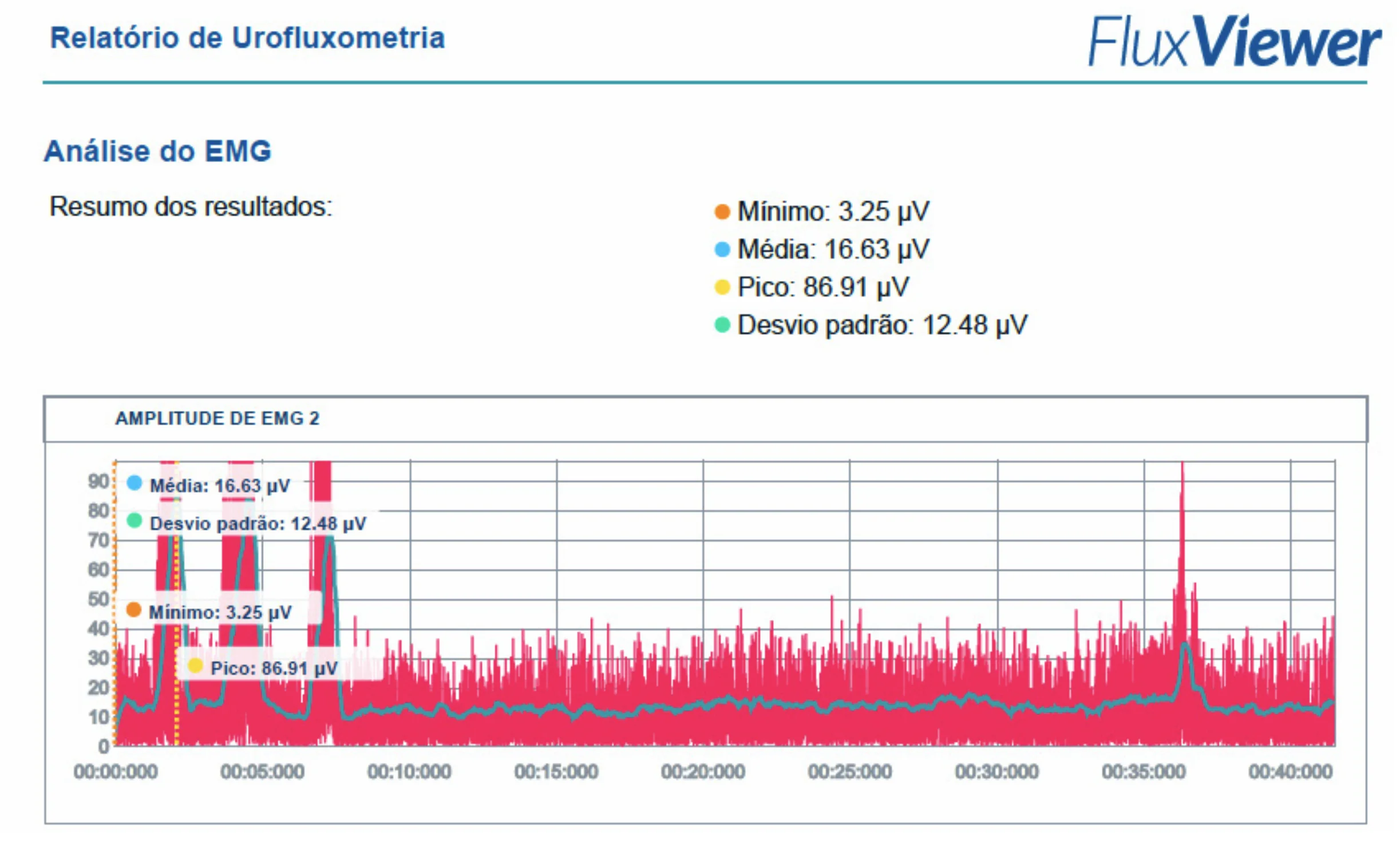 Relatório de urofluxometria do FluxViewer com análise do EMG