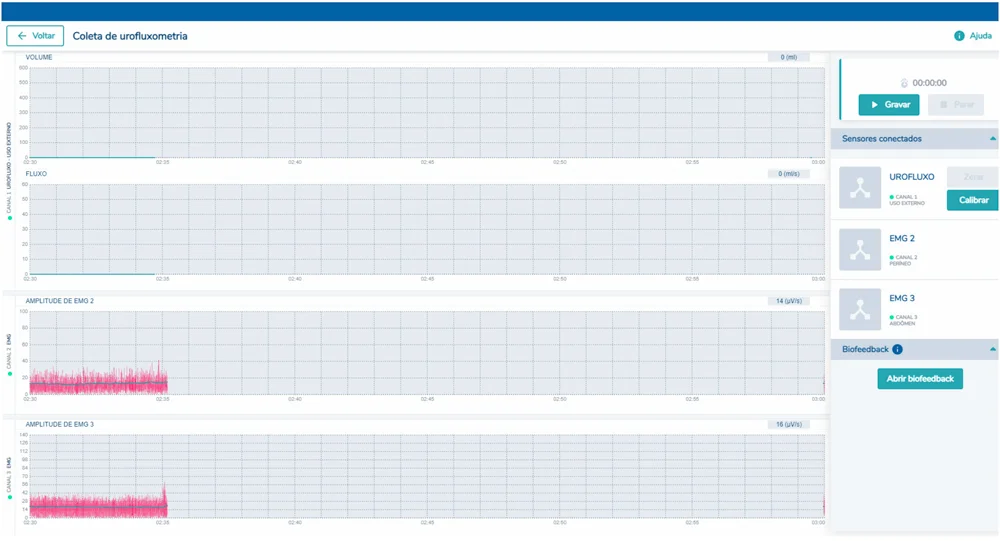 Coleta de urofluxometria com sensores de fluxo e EMG no FluxViewer