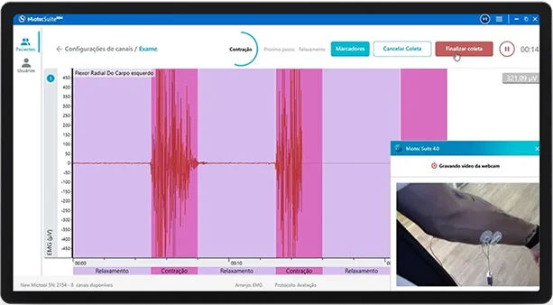 Interface do MiotecSuite MS4 com coleta e vídeo sincronizados