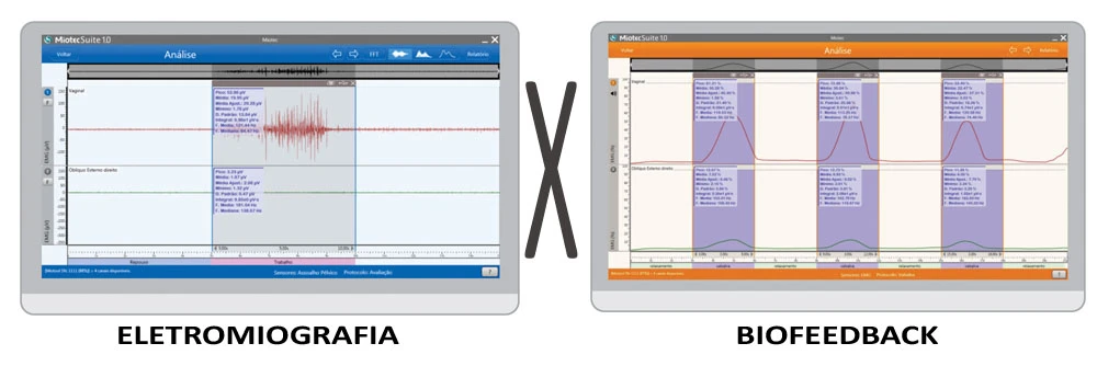 Você sabe a diferença entre Eletromiografia e Biofeedback Eletromiográfico ?
