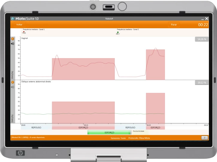 6 dispositivos de biofeedback que aumentam a eficiência da terapia pélvica